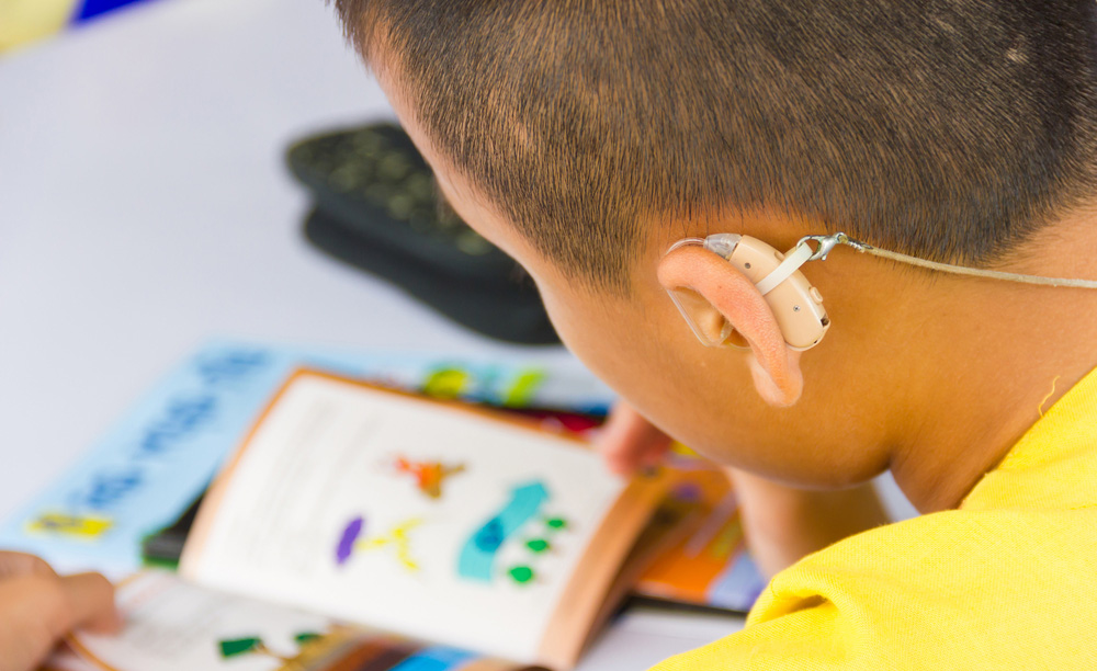 Fotografía de un niño con audífono