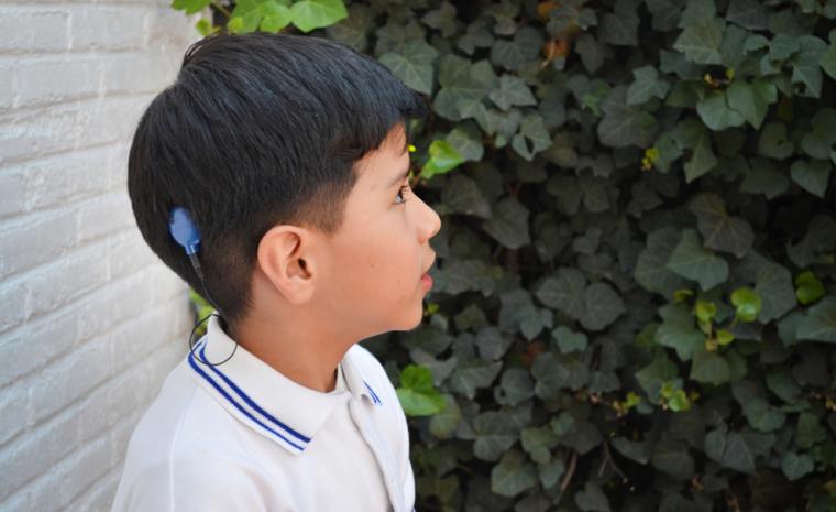 Fotograf&iacute;a de un ni&ntilde;o con un implante coclear