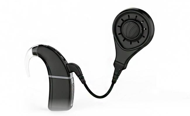 Imagen comercial del implante coclear Enduro de Nurotron